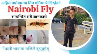 Understand Nairobi Fly 🪰 Bites  Symptoms and Treatment In Nepali Language   Nairobi Fly 