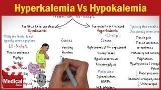 Hyperkalemia Vs Hypokalemia  EASY TO REMEMBER 