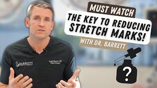 How Do You Get Rid of Stretch Marks?  Barrett Plastic Surgery.