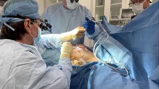 Watch This  Breast Augmentation Procedure From Start To Finish At Vitenas Cosmetic Surgery