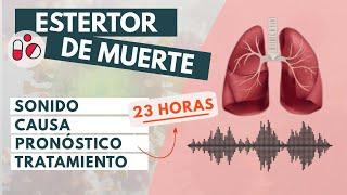 ¿Cómo suena el estertor de la muerte?   Señales de aproximación a la muerte