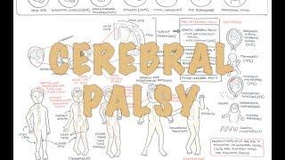 Cerebral Palsy - DETAILED Overview