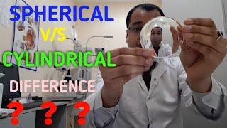 Spherical Vs Cylindrical lenses Difference in Cylindrical power and Spherical power Astigmatism