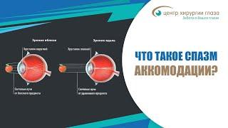 Усталость и ощущение напряжения глаз снижение зрения - это проявления спазма аккомодации