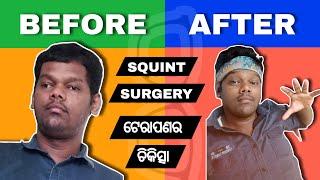 squint eye surgery in odia Odisha  squint eyes odia  squint eye correction exercises in odia