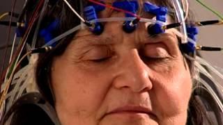EEG - Elektroenzephalographische Untersuchung im nerv zentrum für neurologie Zürich