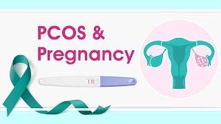 PCOS and Pregnancy