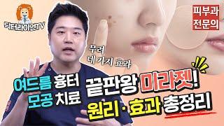 여드름 흉터 정복 3탄 여드름 흉터모공 치료 끝판왕 미라젯 원리 효과 가격 총정리