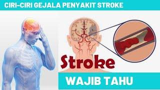 7 Gejala Awal Penyakit Stroke yang Harus Diwaspadai