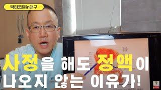 사정을 해도 정액이 나오지 않는 이유가 비뇨기과 닥터코넬