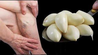 Leg pain rheumatism varicose veins arthritis headache joint pain. Moms Natural Remedy