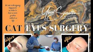 Cat Eyes Surgery in TURKEY  With Op. Dr. Yücel Sarıaltın