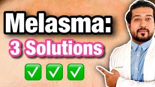 Melasma Treatment on ANY SKIN  How to Get Rid of Melasma Quick