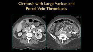 CTisus Most Popular Cases Part 1