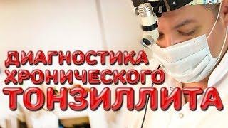 Диагностика хронического тонзиллита  Лечим правильно с Владимиром Зайцевым