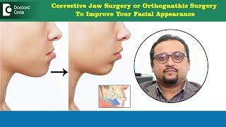 Corrective JawOrthognathic Surgery for improved Facial Appearance-Dr.Vybhav DerajeDoctors Circle