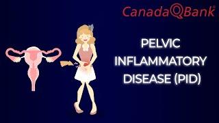 Pelvic Inflammatory Disease PID