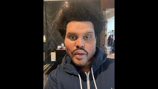 La verdad detrás del extraño aspecto del rostro de The Weeknd