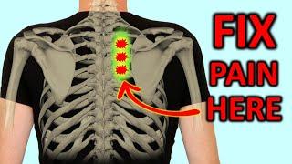 Rhomboid Pain How To Fix Shoulder Blade Pain Quickly.