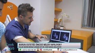 Op. Dr. Cem KARAS İle Burun Estetiği Öncesi Yapılan İşlemler