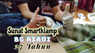 sunat perbaikan bang riadi 27 tahun metode smartklamp  ruangsunat_medan