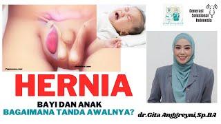 #VE006 Hernia Bayi dan Anak Yuk Kenali Tanda Awal biar ga Fatal  dr. Gita Anggreyni Sp.BA