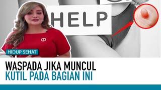 AWAS Kutil Kelamin Bisa Menular Kenali Cirinya  Tips Sehat