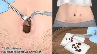 ASMR belly care Animation