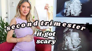 SECOND TRIMESTER RECAP scary timeshigh risk weird symptoms products that saved me  leighannsays