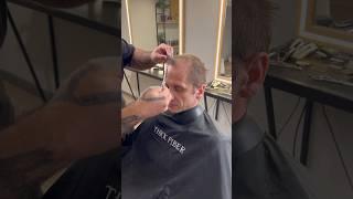 Makeover Thinning & Balding Hairstyle
