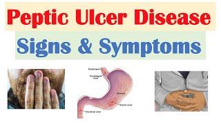 Peptic Ulcer Disease Signs & Symptoms  Gastric vs. Duodenal Ulcers