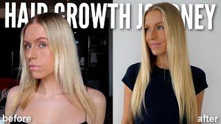 My 3 Year HAIR LOSS to HAIR GROWTH Journey *My NEW Routine & Results 2023*