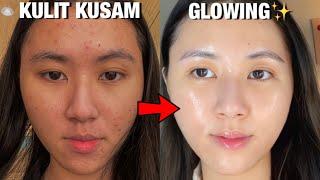 5 CARA AMPUH Untuk KULIT CERAH & GLOWING  Dari Kusam jadi Glowing 