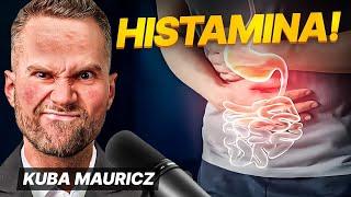 HISTAMINA - źle się czuję ale nikt nie wie dlaczego  Jakub Mauricz