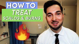 Burns  How To Treat Burns  How To Treat A Burn