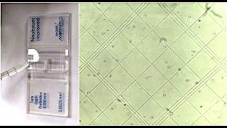 Semen Analysis Test Lab  Sperm Count Test