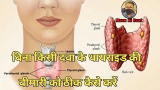 How to control thyroid without any medicine  बिना किसी दवा के थायराइड की बीमारी को ठीक कैसे करें
