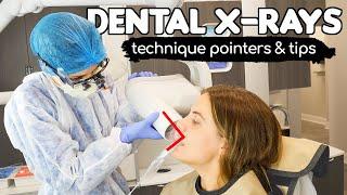 How To Take PERFECT Dental X-rays  Tips & Tricks From A Dental Hygienist