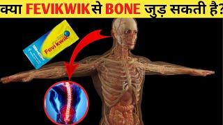 क्या FEVIQUICK से टूटी हड्डी जुड़ सकती है?  Can we Fix Cracked Bone With Fevikwik?  Facts 