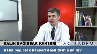 Kalın bağırsak kanseri nasıl teşhis edilir ?