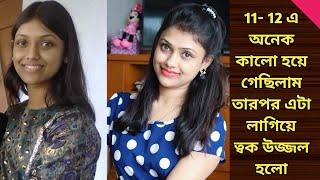 11- 12 এ অনেক কালো হয়ে গেছিলাম  How To Make Skin Glow  Skin Fairness Face Pack