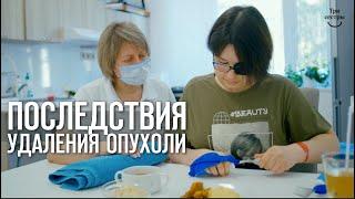 Последствия удаления опухоли реабилитация и лечение после операции