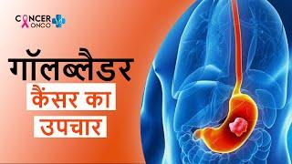 Gallbladder cancer गॉलब्लेडर कैंसर का उपचार  Gallbladder Cancer Treatment in Hindi