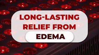 Long-lasting relief from edema  Nation Health  Lisa King RPh