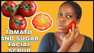 Tomato and sugar face scrub to clear acne pimples and dark spotsskin whiteningBlizzyivy beauty