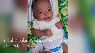 Bayi terlahir prematur 33 minggu