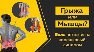 Боль в спине отдает в ногу. Как не спутать грыжу с болью в мышцах? Техники и приемы.