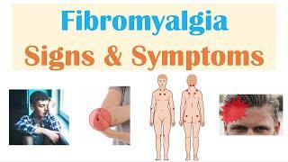 Fibromyalgia  Signs & Symptoms Associated Conditions