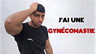 J’AI UNE GYNÉCOMASTIE  JE VOUS DIS TOUT ️