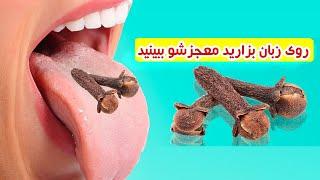 چند عدد میخک رو روی زبان بگذارید و نتیجه آن